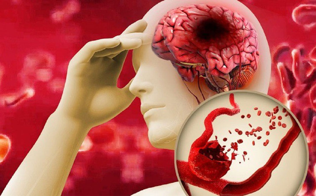 Vien-uong-chong-dot-quy-Nhat-Ban-hieu-qua-duoc-su-dung-nhieu-02